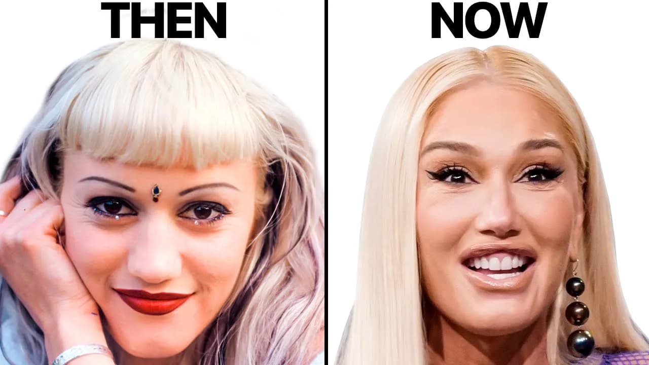 Gwen Stefani NEW FACE | Plastic Surgery Analysis
