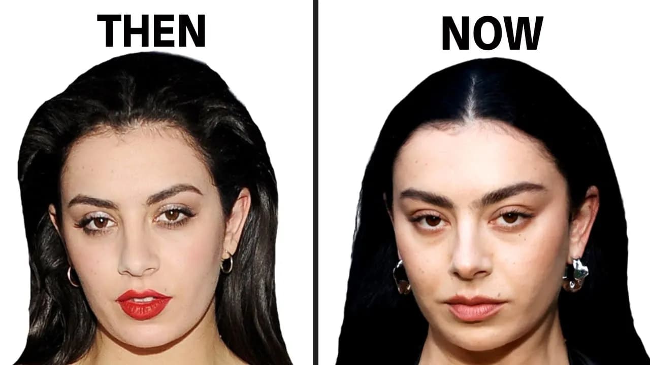 Charli XCX Plastic Surgery: Transparency Queen or Not