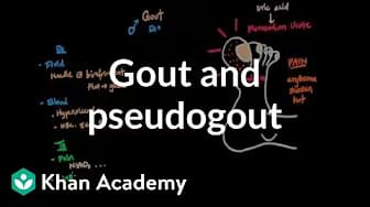 Muscular-skeletal diseases | NCLEX-RN | Khan Academy